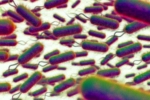 E.coli Outbreak breaking updates, E.coli Outbreak UK, all about e coli outbreak in the united kingdom, Manto
