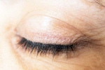 Eyelash Dandruff, Eyelash Dandruff updates, all about eyelash dandruff, Makeup