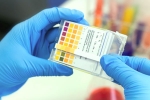 CRISPR, genome, everything about feluda a low cost covid 19 test in india, Cgi