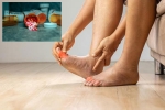 Gout Drugs breaking, Gout Drugs updates, gout drugs may cut the risk of heart attack, Usa Gout Drugs breaking, Gout Drugs updates, gout drugs may cut the risk of heart attack, Usa