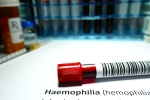 Hemophilia men, Hemophilia health tips, why are men likely to develop hemophilia, Minor