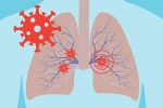 cytokine storm syndrome, immune system, how does covid 19 affect different parts of the body, Covid toe