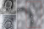 coronavirus, imaging, indian scientists reveal images of the novel coronavirus under a microscope, Imaging