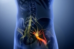 Sciatica nerve, Sciatica nerve, help yourself on sciatica, Natural remedies