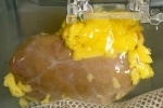 Universal Kidney latest update, Universal Kidney breaking, scientists develop universal kidney transplanted to any blood group, Universal kidney