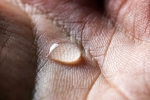 Sweaty Hands And Feet, Ways To Treat Sweaty Hands And Feet, 10 ways to treat sweaty hands and feet, Black tea