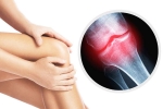 Bone Health Decline, Bone Health Decline tips, signs and symptoms of bone health decline, Malai