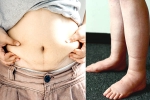 Water Retention health tips, Water Retention survey, some effective ways to reduce water retention, Heart diseases