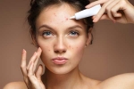what your face says about your health, face mapping chart, what your face is telling you about your health, Dark circles