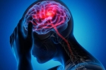 Canada Brain Disease study, Canada Brain Disease breaking news, canada is hit by a mysterious brain disease, Cmo Canada Brain Disease study, Canada Brain Disease breaking news, canada is hit by a mysterious brain disease, Cmo