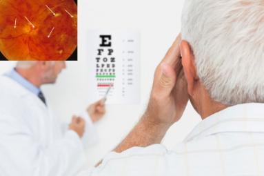 Eye Vision may be restored in diabetes patients ? },{