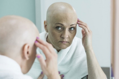 New Cancer Treatment Prevents Hair Loss from Chemotherapy